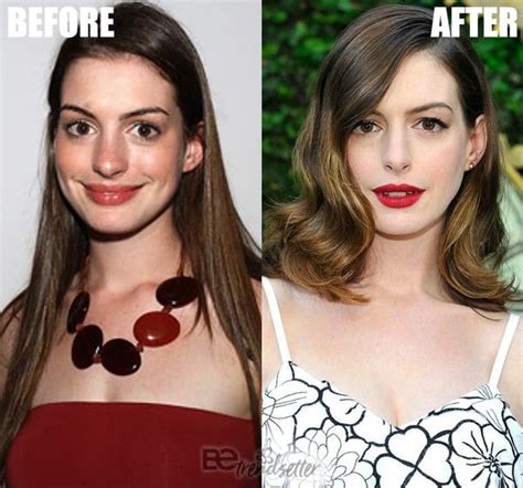 what is anne hathaway doing now